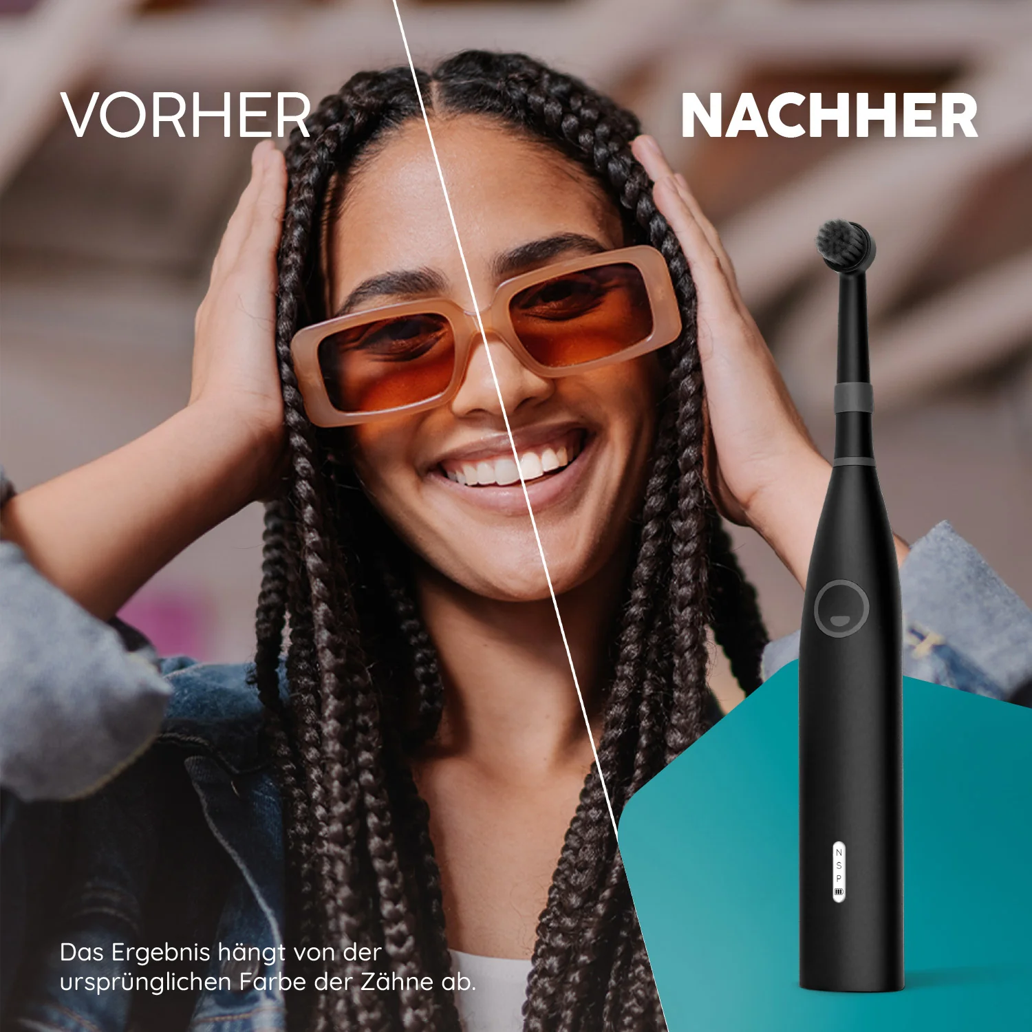 Eco R2 Klassik-Set | Allblack - Image 9